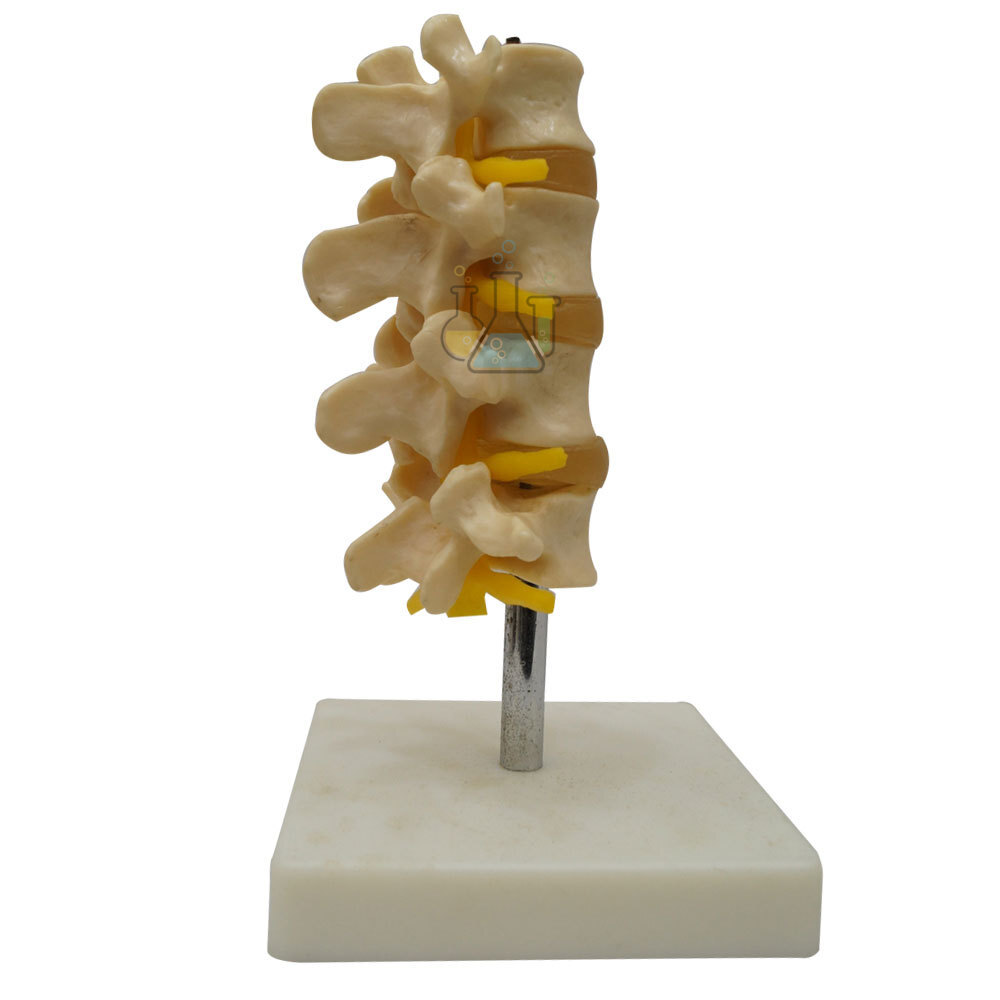 Three Lumbar Vertebrae